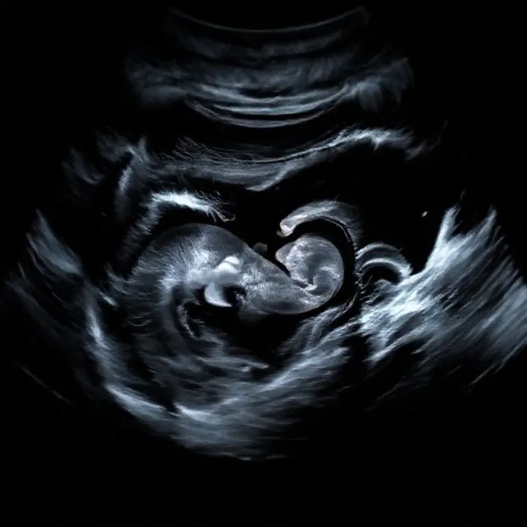 結論：最終要約及び胎児超音波検査の未来方向性提示